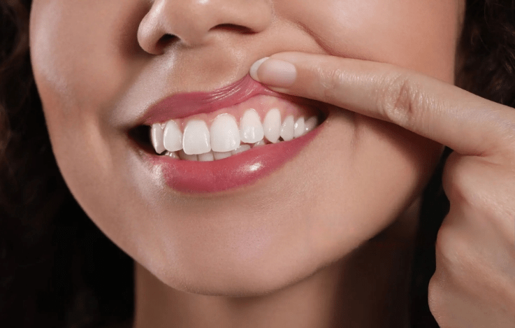 Why You Should Take Care Of Your Gums