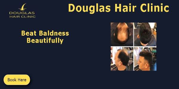 douglas hair clinic